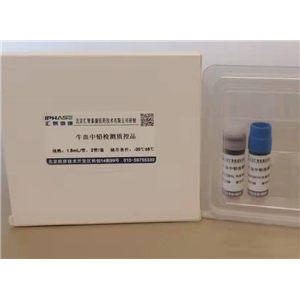 CD34+T细胞分选试剂盒