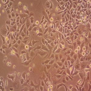 人急性单核细胞白血病细胞