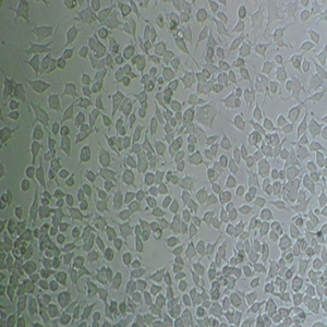 人急性T淋巴细胞白血病细胞,D1.1 Cells