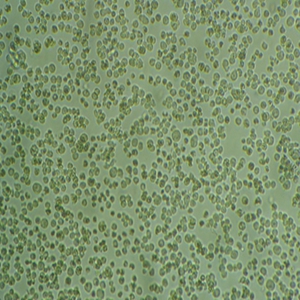 人弥漫大B细胞淋巴瘤细胞,DB Cells