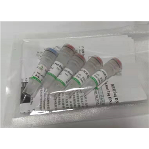 大鼠钙/钙调素依赖性蛋白激酶2(CAMK2)Elisa试剂盒