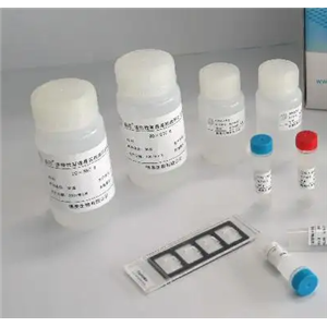 人5核苷酸酶(5-NT)Elisa试剂盒