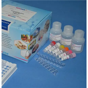 人胰淀粉酶(PAMY)Elisa试剂盒