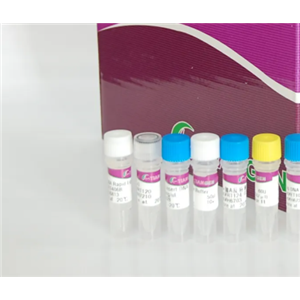 人八聚体转录因子(OTF2B)Elisa试剂盒