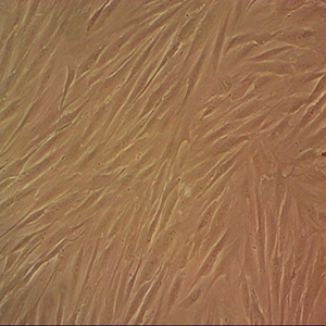 HFLS-RA人细胞