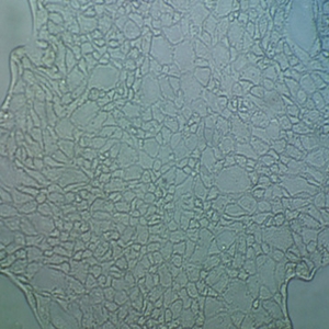 NCI-H358人細(xì)胞