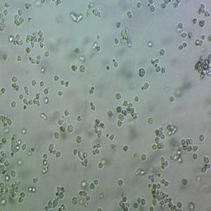NCI-H520人细胞