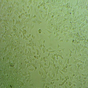 Hep-2细胞