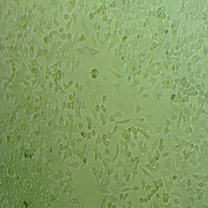 SUNE-1 5-8F细胞