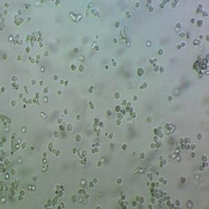 SUNE-1 6-10-B细胞