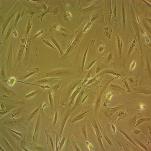 SW1116人肠腺细胞