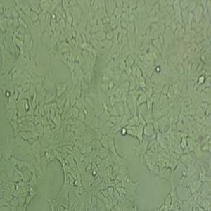 SJSA-1人骨肉细胞