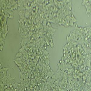 Hep-3B人肝细胞