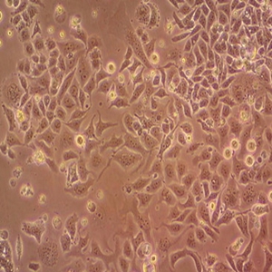 H522人肺腺細(xì)胞