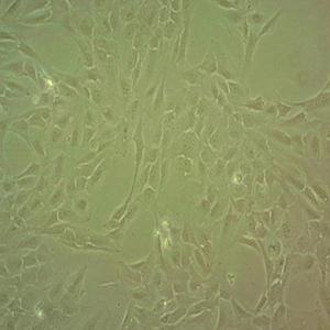 DMS153人小细胞肺细胞
