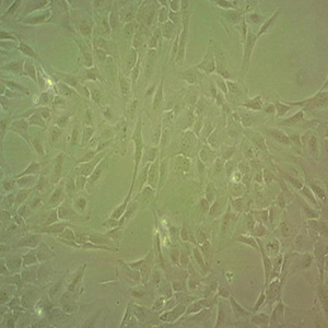 Calu-3人肺腺细胞,Calu-3