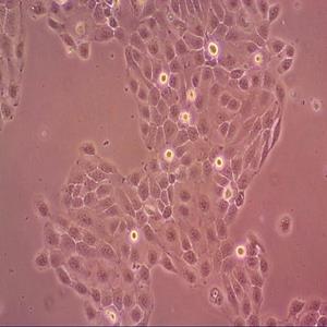THP-1人急性单核细胞病细胞