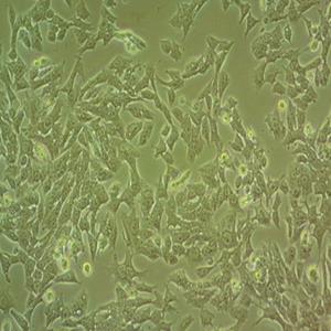 人恶性胚胎横纹肌肉细胞,TE671 subline No.2