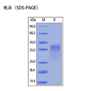 细胞程序性死亡蛋白,PD-1