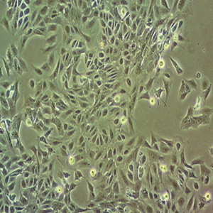 人肾透明细胞腺细胞