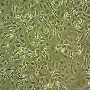 BALB/3T3 clone A31小鼠胚胎成纤维细胞