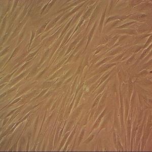 SAC-IIC3小鼠腹水细胞