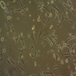 5TGM1-GFP-LUC小鼠骨髓瘤双荧光细胞