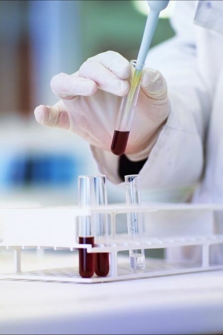 HMGB1 (Human) Recombinant Protein (P01),HMGB1 (Human) Recombinant Protein (P01)