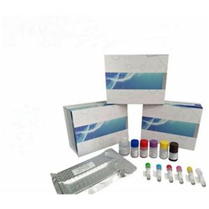 Human Perilipin 1 (PLIN1) ELISA Kit