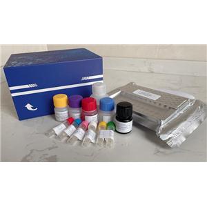 唾液外泌体纯化试剂盒（提取试剂盒）,Saliva Exosome Purification Kit