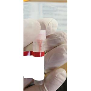 8-异前列腺素检测ELISA试剂盒-96次分析（可拆卸）