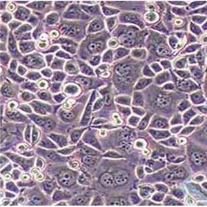 AGS人胃腺癌细胞（STR鉴定正确）