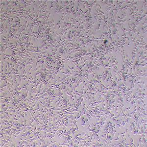 3T3-L1小鼠胚胎成纤维细胞,Mouse Embryonic Fibroblasts Cells