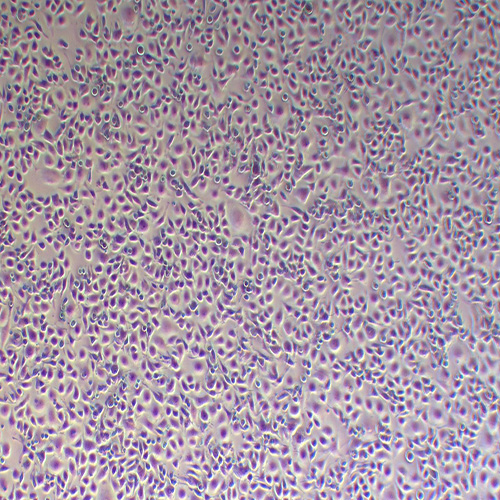 G422小鼠神经胶质瘤细胞