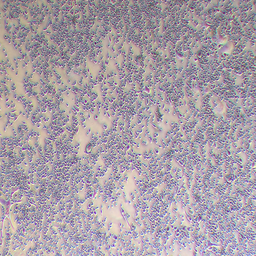 WEHI 164小鼠纤维肉瘤细胞