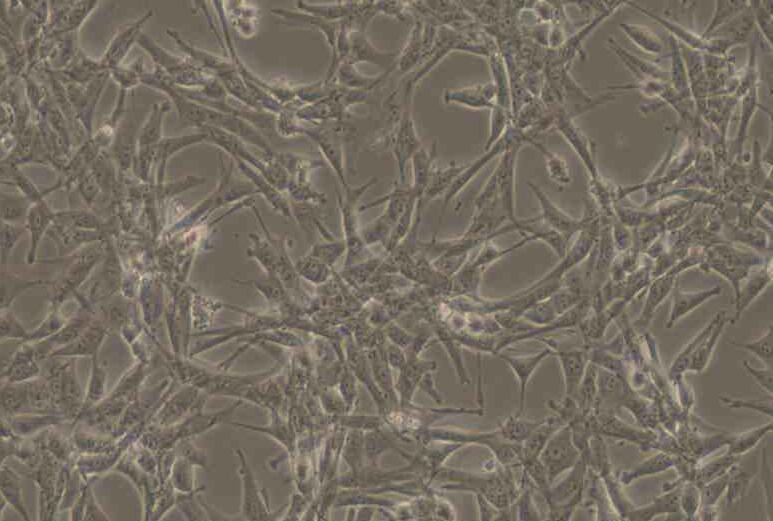 ES-2（人卵巢透明细胞癌细胞）,ES-2