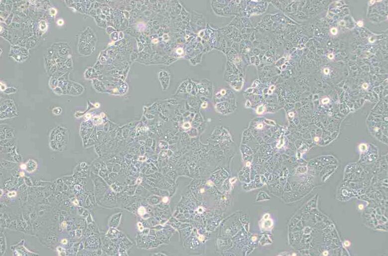 HEC-1-A（人子宫内膜腺癌细胞）,HEC-1-A