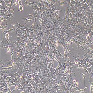 4T1小鼠乳腺癌细胞（种属鉴定正确）