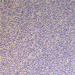 B16F10小鼠皮肤黑色素瘤细胞