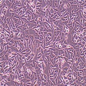 B16小鼠黑色素瘤细胞