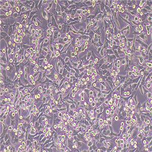 CT26小鼠结肠癌细胞（种属鉴定正确）