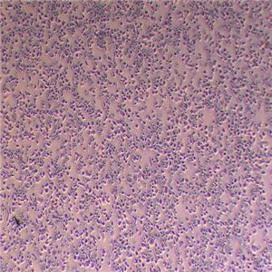 hepa1-6小鼠肝癌细胞