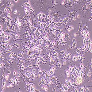 K7M2WT小鼠骨肉瘤成骨细胞