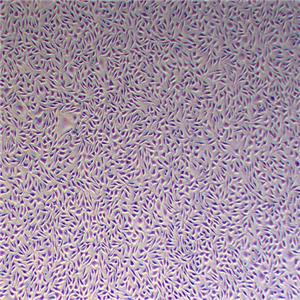 MC38小鼠结肠癌细胞