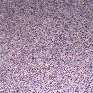 MFC小鼠胃癌细胞（种属鉴定正确）