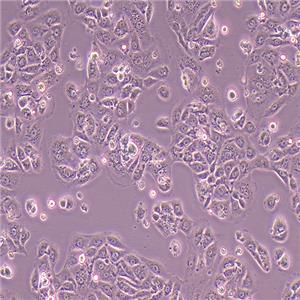 MPC-5小鼠肾足细胞（种属鉴定正确）