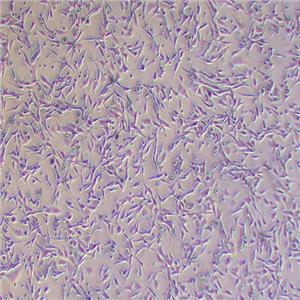 pan02小鼠胰腺癌细胞（种属鉴定正确）