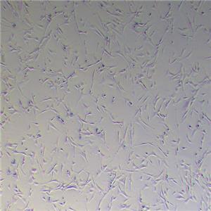 小鼠肺成纤维细胞（永生化）
