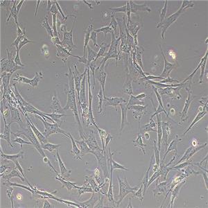 小鼠肺成纖維細(xì)胞（永生化）