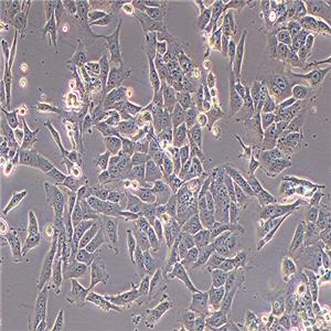 143B人骨肉瘤细胞（STR鉴定正确）